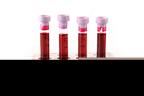 test tubes containing blood